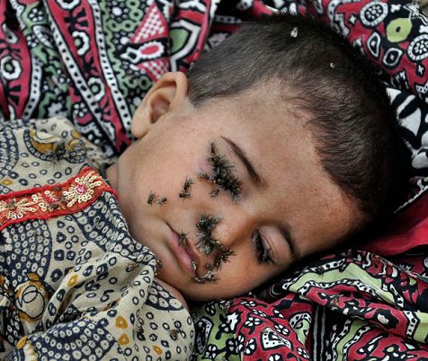 巴基斯坦灾童躺满街道 全身爬满苍蝇