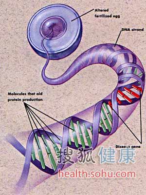 瑞典研究出可防蛀牙和乳酸菌