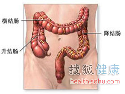 肠癌是可以预防的！